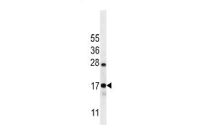 C Antibody (C-term) (ABIN656606 and ABIN2845863) western blot analysis in Ramos cell line lysates (35 μg/lane).