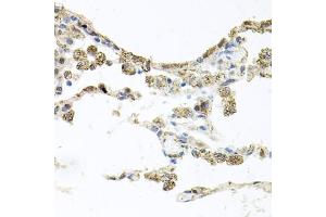 Immunohistochemistry of paraffin-embedded human lung using PIK3CB antibody (ABIN5970370) at dilution of 1/100 (40x lens). (PIK3CB Antikörper)
