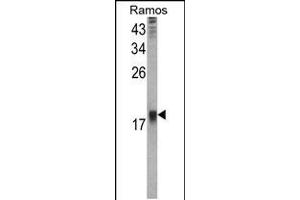 Western blot analysis of UBE2B Antibody in Ramos cell line lysates (35ug/lane)