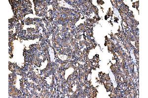 IHC analysis of IRBIT/AHCYL1 using anti-IRBIT/AHCYL1 antibody (ABIN7600030).