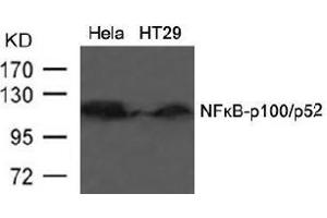 Image no. 3 for anti-Nuclear Factor of kappa Light Polypeptide Gene Enhancer in B-Cells 2 (NFKB2) (AA 864-868) antibody (ABIN197118) (NFKB2 Antikörper  (AA 864-868))