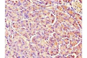 Immunohistochemistry of paraffin-embedded human pancreatic tissue using ABIN7158464 at dilution of 1:100 (REG1A Antikörper  (AA 23-166))
