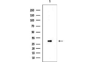 Western blot analysis of lysates from EC304 cells, using Ribosomal Protein S2 Mouse Monoclonal Antibody at 1/1000 dilution.