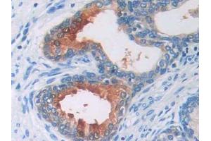 DAB staining on IHC-P; Samples: Human Prostate Tissue (AGT Antikörper  (AA 35-485))