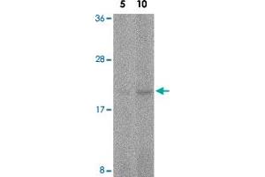 Western blot analysis of FAIM in human spleen tissue lysate with FAIM polyclonal antibody  at 5 and 10 ug/mL . (FAIM Antikörper  (C-Term))