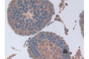 Immunohistochemistry (IHC) image for anti-Pro-Platelet Basic Protein (Chemokine (C-X-C Motif) Ligand 7) (PPBP) (AA 46-107) antibody (ABIN7431665)