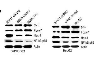 Effect of STAT1 on p53, Fbxw7, Hes-1 and NF-κB p65. (FBXW7 Antikörper  (AA 501-600))
