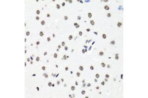 Immunohistochemistry of paraffin-embedded mouse brain using HIST1H2BG antibody (ABIN6003628) at dilution of 1/100 (40x lens). (HIST1H2BG Antikörper)