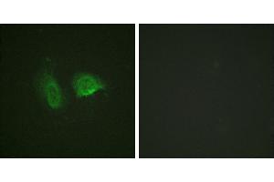 P-peptide - +Western blot analysis of extracts from LOVO cells, using Calcium Sensing Receptor (Phospho-Thr888) antibody. (CASR Antikörper  (pThr888))
