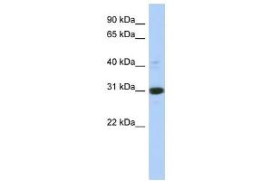 IMPA1 antibody used at 1 ug/ml to detect target protein.