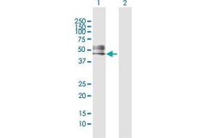 Western Blot analysis of RTN4R expression in transfected 293T cell line by RTN4R MaxPab polyclonal antibody. (RTN4R Antikörper  (AA 1-473))