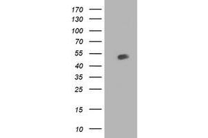 HEK293T cells were transfected with the pCMV6-ENTRY control (Left lane) or pCMV6-ENTRY BECN1 (Right lane) cDNA for 48 hrs and lysed. (Beclin 1 Antikörper)