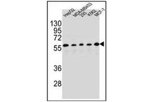 Western blot analysis of PAX1 Antibody (C-term) in HepG2, MDA-MB453, 293, K562, MCF-7 cell line lysates (35ug/lane).