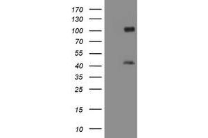 Image no. 1 for anti-Melanoma Antigen Family A, 9 (MAGEA9) antibody (ABIN1499263)