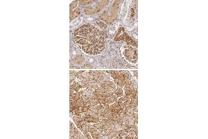 Immunohistochemical staining of human heart muscle with LAMB2 polyclonal antibody  shows distinct membranous positivity in myocytes.