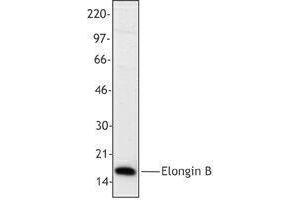 Western Blotting (WB) image for anti-Transcription Elongation Factor B (SIII), Polypeptide 2 (18kDa, Elongin B) (TCEB2) antibody (ABIN2666332) (TCEB2 Antikörper)