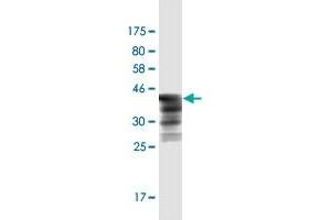 Western Blot detection against Immunogen (44. (HSPB7 Antikörper  (AA 1-170))