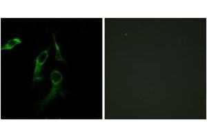 Immunofluorescence analysis of HepG2/HeLa cells, using HARS Antibody. (HARS1/Jo-1 Antikörper  (AA 460-509))