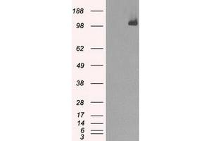 Image no. 5 for anti-Budding Uninhibited By Benzimidazoles 1 Homolog beta (Yeast) (BUB1B) antibody (ABIN1496995) (BUB1B Antikörper)