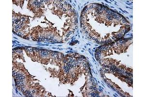 Immunohistochemical staining of paraffin-embedded Kidney tissue using anti-RALBP1 mouse monoclonal antibody. (RALBP1 Antikörper)
