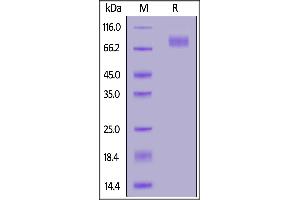 SDS-PAGE (SDS) image for SARS-CoV-2 Spike S2 (B.1.1.7 - alpha) (Active) protein (His tag) (ABIN6992374)