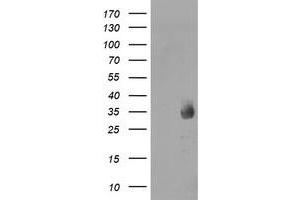Western Blotting (WB) image for anti-Methylmalonic Aciduria (Cobalamin Deficiency) CblC Type, with Homocystinuria (MMACHC) antibody (ABIN1499512)
