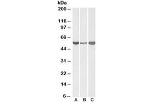 Western blot testing of human [A] and mouse [B] liver, and rat [C] testis lysate with ALDH1A1 antibody at 0. (ALDH1A1 Antikörper)