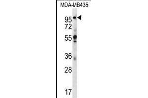 CTAGE5 Antibody (C-term) (ABIN656676 and ABIN2845915) western blot analysis in MDA-M cell line lysates (35 μg/lane). (MIA2 Antikörper  (C-Term))