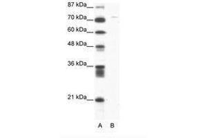 Image no. 1 for anti-Aspartate beta-Hydroxylase (ASPH) (AA 312-361) antibody (ABIN202902) (Aspartate beta Hydroxylase Antikörper  (AA 312-361))