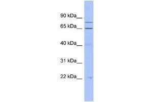 WB Suggested Anti-ZNF431 Antibody Titration:  0.