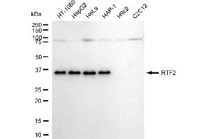 anti-Replication Termination Factor 2 (RTF2) antibody