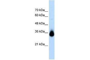 WB Suggested Anti-HOXC9 Antibody Titration:  2.