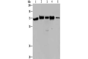 Gel: 8 % SDS-PAGE, Lysate: 40 μg, Lane 1-5: A172 cells, Hela cells, 293T cells, K562 cells, human testis tissue, Primary antibody: ABIN7128290(AGFG1 Antibody) at dilution 1/727, Secondary antibody: Goat anti rabbit IgG at 1/8000 dilution, Exposure time: 40 seconds (AGFG1 Antikörper)