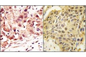Image no. 2 for anti-SUMO1/sentrin Specific Peptidase 5 (SENP5) (C-Term) antibody (ABIN356757) (SENP5 Antikörper  (C-Term))