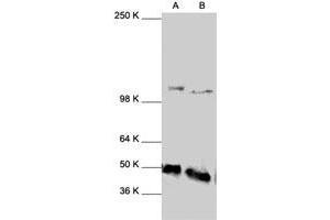 Western Blot analysis of NFKB1 polyclonal antibody  expression in HeLa (A) and HL-60 (B) whole cell lysates. (NFKB1 Antikörper  (C-Term))