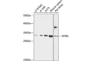 Western blot analysis of extracts of various cell lines using SPSB1 Polyclonal Antibody at dilution of 1:1000. (SPSB1 Antikörper)