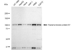 Western blotting analysis using Transmembrane protein 67 antibody (ABIN7800623).