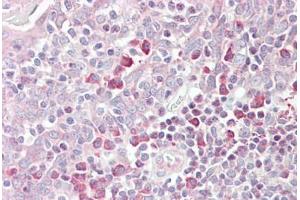 Anti-MARCH6 antibody IHC staining of human tonsil. (MARCH6 Antikörper  (AA 886-898))