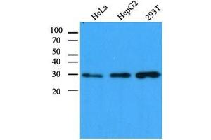 The cell lysates (40 ug) were resolved by SDS-PAGE, transferred to PVDF membrane and probed with anti-human CBR1 antibody (1:1,000). (CBR1 Antikörper  (AA 1-277))