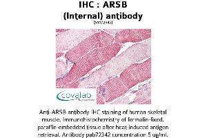 Image no. 1 for anti-Arylsulfatase B (ARSB) (Internal Region) antibody (ABIN1731968) (Arylsulfatase B Antikörper  (Internal Region))