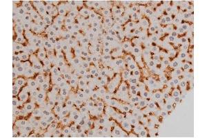 Immunohistochemistry (IHC) image for anti-Ezrin (EZR) (pTyr478) antibody (ABIN6255926)