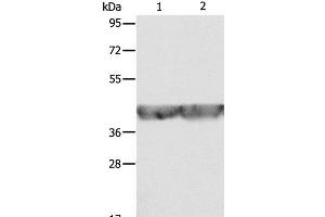 Western Blot analysis of A549 and hela cell using ALDOA Polyclonal Antibody at dilution of 1:500 (ALDOA Antikörper)