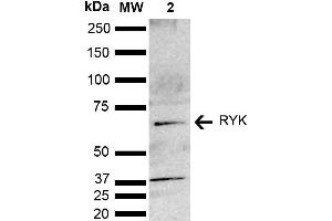 Western blot analysis of Mouse brain lysate showing detection of ~67. (RYK Antikörper  (AA 150-250) (Biotin))