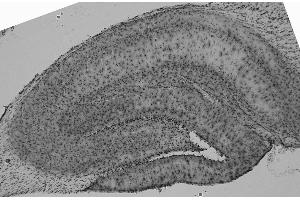 Adult rat hippocampus immunohistochemistry (high and low magnification).