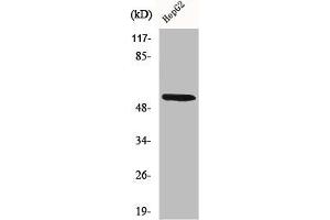 Western Blot analysis of 293 cells using CYP26A1 Polyclonal Antibody (CYP26A1 Antikörper  (Internal Region))