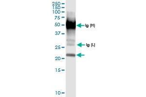 Immunoprecipitation of GLO1 transfected lysate using anti-GLO1 MaxPab rabbit polyclonal antibody and Protein A Magnetic Bead , and immunoblotted with GLO1 MaxPab rabbit polyclonal antibody (D01) . (GLO1 Antikörper  (AA 1-184))