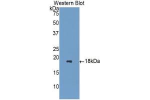 Western blot analysis of the recombinant protein. (HPSE Antikörper  (AA 400-543))