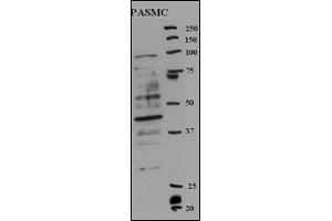 Western blot analysis of anti-RFC5 Antibody (Center ) (ABIN389314 and ABIN2839435) in rat SMC cell line lysates (35 μg/lane).