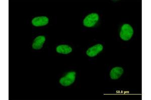 Immunofluorescence of purified MaxPab antibody to CDK7 on HeLa cell. (CDK7 Antikörper  (AA 1-346))
