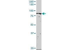 FLI1 monoclonal antibody (M02), clone 2G8. (FLI1 Antikörper  (AA 1-452))